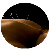 Dry Needling Physical Therapy - Portsmouth, Dover, Kittery NH 