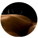 Trigger Point Dry Needling - Seacoast Sports Injuries 