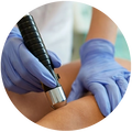 Shock Wave Therapy - Seacoast Sports Injuries 